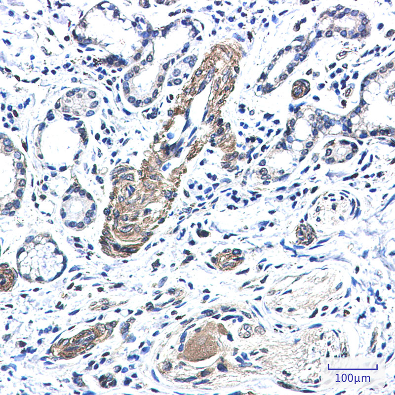 FXR1 Rabbit mAb